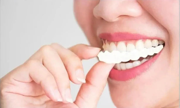 Carillas Dentales  💎 ¡La Sonrisa que Siempre Soñaste Comienza Hoy – Fácil, Rápido y Sin Dolor! 🚀 ENVÍO GRATIS!