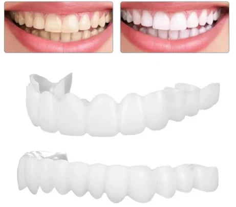 Carillas Dentales  💎 ¡La Sonrisa que Siempre Soñaste Comienza Hoy – Fácil, Rápido y Sin Dolor! 🚀 ENVÍO GRATIS!