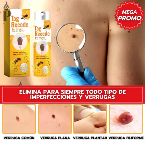 🐝 TAG RECEDE – ¡Dile Adiós a Verrugas, Lunares y Manchas en Pocos Días!