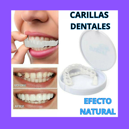 Carillas Dentales  💎 ¡La Sonrisa que Siempre Soñaste Comienza Hoy – Fácil, Rápido y Sin Dolor! 🚀 ENVÍO GRATIS!