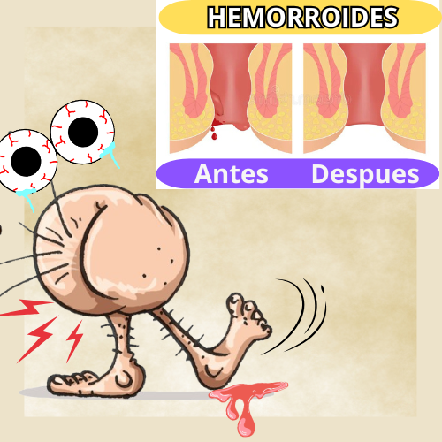 HERBAL CREAM Hemorroides